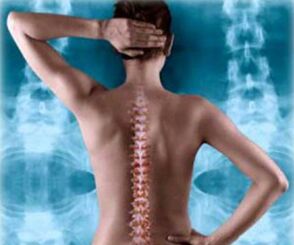 ilustracija hrbtne hrbtenice