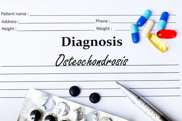 zdravila za diagnosticiranje osteohondroze