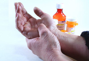 metode zdravljenja artritisa in artroze
