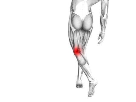 Osteoartritis kolenskega sklepa