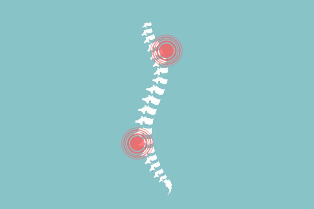 človeške bolečine v hrbtenici in hrbtu