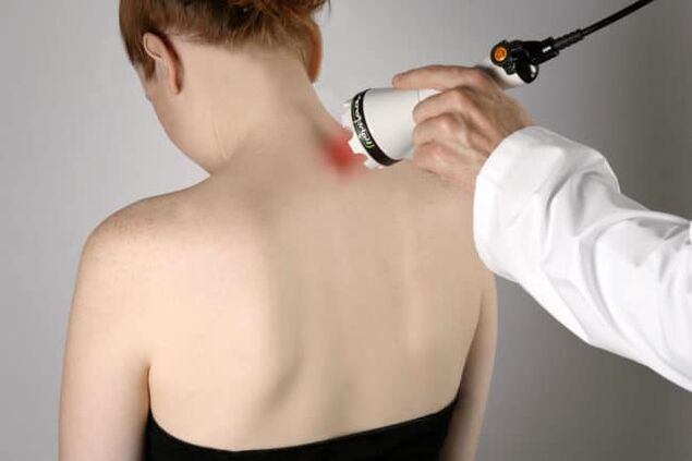 Laserska terapija se uporablja za boj proti bolečinam v hrbtu v predelu lopatice. 