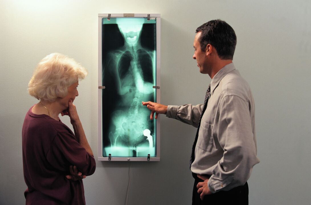 rentgenska diagnostika bolečine v kolčnem sklepu